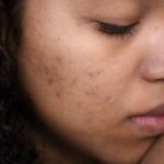 Extreme close-up of a woman's face showing skin imperfections and calm expression.